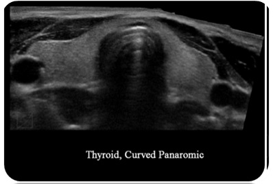 04 Curved panoramic imaging