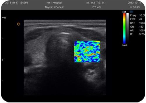 10 Elastography
