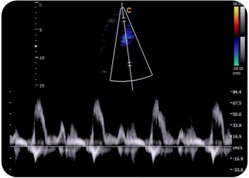 11 HPRF (High Pulse Reputation Frequency)