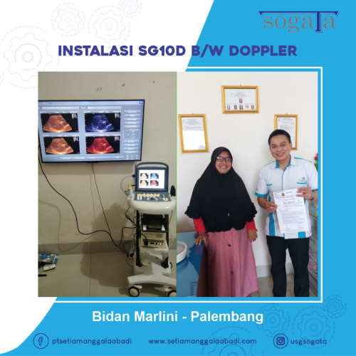 Bidan Marlini - Palembang SG10D BW Doppler