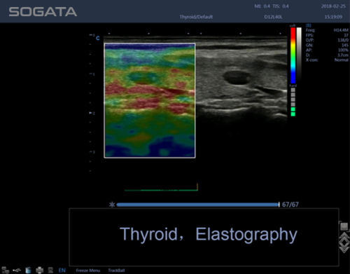 Quantative Elastography