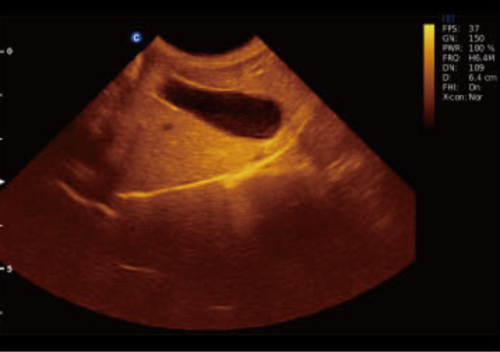 Canine Gall Bladder, B Mode