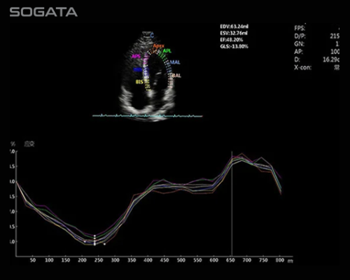 Strain And Strain Rate